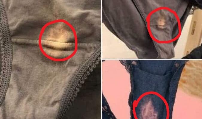 If you find a “bleach” patch in your underwear, you had better know what it means I had no idea